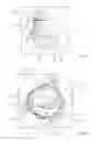 Fig. 02 - Prosthetic breast support