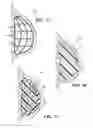 Fig. 11 - Breast and nipple implant constructions