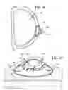 Fig. 14 - Breast and nipple implant constructions