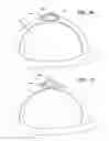 Fig. 15 - Breast and nipple implant constructions