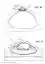 Fig. 16 - Breast and nipple implant constructions