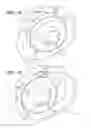 Fig. 22 - Breast and nipple implant constructions