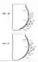 Fig. 24 - Breast and nipple implant constructions
