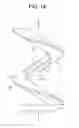 Fig. 02 - Intervertebral ligament having a helical bone fastener
