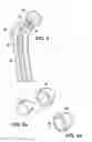 Fig. 05 - SHAPED LOAD-BEARING OSTEOIMPLANT AND METHODS OF MAKING THE SAME