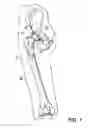 Fig. 06 - SHAPED LOAD-BEARING OSTEOIMPLANT AND METHODS OF MAKING THE SAME