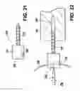 Fig. 13 - SHAPED LOAD-BEARING OSTEOIMPLANT AND METHODS OF MAKING THE SAME