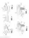 Fig. 04 - Dynamic interbody cage anchor system