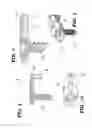 Fig. 05 - Dynamic interbody cage anchor system