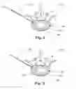 Fig. 03 - REPLACEMENT OR SUPPLEMENTATION OF A NUCLEUS PULPOSUS USING A HYDROGEL