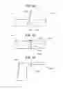 Fig. 11 - Methods and devices for expanding a spinal canal