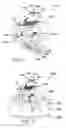 Fig. 07 - Minimally invasive lateral intervertebral fixation system, device and method