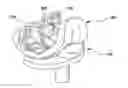 Fig. 01 - Knee prosthesis
