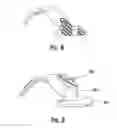 Fig. 06 - Knee prosthesis