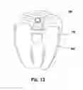 Fig. 08 - Knee prosthesis