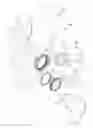 Fig. 01 - Multi-bearing acetabular prosthesis