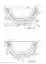 Fig. 03 - Multi-bearing acetabular prosthesis