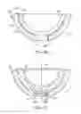 Fig. 07 - Multi-bearing acetabular prosthesis