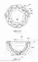 Fig. 10 - Multi-bearing acetabular prosthesis