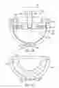 Fig. 15 - Multi-bearing acetabular prosthesis