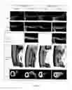 Fig. 04 - Elastomeric, Polymeric Bone Engineering and Regeneration Compositions and Methods of Making