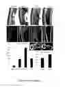 Fig. 05 - Elastomeric, Polymeric Bone Engineering and Regeneration Compositions and Methods of Making