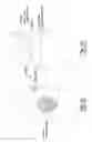 Fig. 02 - TRANSTIBIAL SOCKET FOR EXTERNAL PROSTHESIS