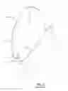 Fig. 05 - TRANSTIBIAL SOCKET FOR EXTERNAL PROSTHESIS