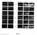 Fig. 09 - CASPASE-8 AND SKIN DISEASE