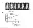 Fig. 06 - Triple-fusion constructs and methods of monitoring human embryonic stem cells