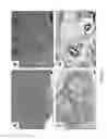 Fig. 35 - Triple-fusion constructs and methods of monitoring human embryonic stem cells