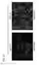 Fig. 40 - Triple-fusion constructs and methods of monitoring human embryonic stem cells