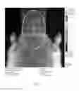 Fig. 04 - F1B-TMIR plasmid vector and transgenic mouse