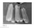 Fig. 08 - hybrids