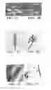 Fig. 03 - Gene silencing