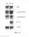 Fig. 07 - Gene silencing