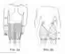 Fig. 03 - Garment