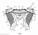 Fig. 04 - NECK PROTECTION DEVICE