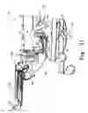 Fig. 31 - Patient-support apparatus with a locking deck section