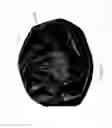 Fig. 02 - Inflatable body contour support cushion
