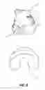 Fig. 09 - DOOR STOP ASSEMBLY HAVING AN INTERCHANGEABLE DECORATIVE HEAD PIECE