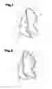 Fig. 02 - METHOD FOR PRODUCING A SHELL PART OF A SPORTS SHOE AND A SHELL PART PRODUCED ACCORDING TO THIS METHOD