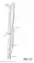 Fig. 13 - LIGHT-BLOCKING WINDOW SHUTTER
