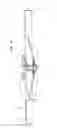 Fig. 06 - Captive toolees fastener for securing an engine intake air filter and clamp assembly for air filter housing