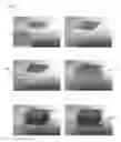 Fig. 07 - Microfluidic electrospray thruster
