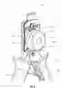 Fig. 07 - Pliers head with a locator
