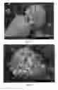 Fig. 07 - METHODS AND COMPOSITIONS USING CALCIUM CARBONATE
