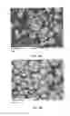 Fig. 34 - METHODS AND COMPOSITIONS USING CALCIUM CARBONATE