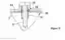 Fig. 08 - Device for adjusting the rotational angular position of a cam shaft