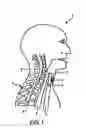 Fig. 02 - Tracheostoma spacer, tracheotomy method, and device for inserting a tracheostoma spacer